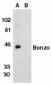 CXCR6 Antibody (N-Terminus)